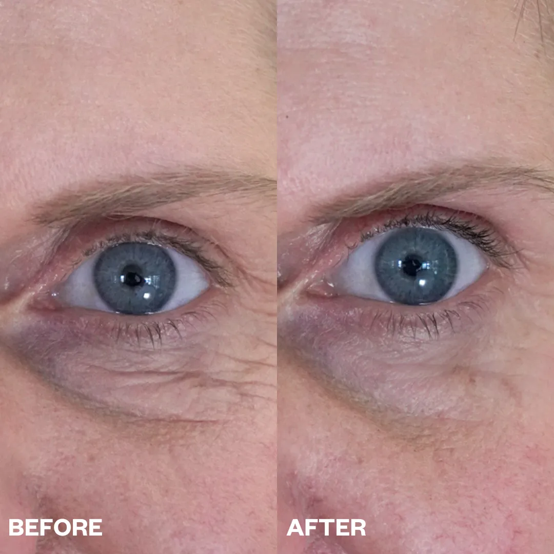 Eye Wrinkle Patches - Single Pair