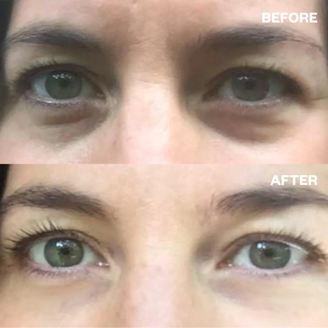 Eye Wrinkle Patches - Single Pair