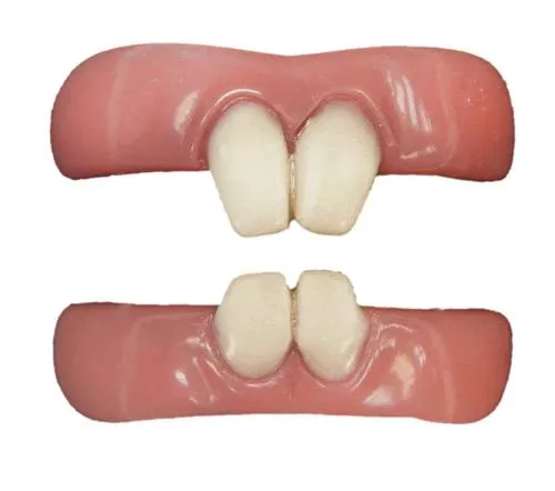 Fx Teeth Vermin