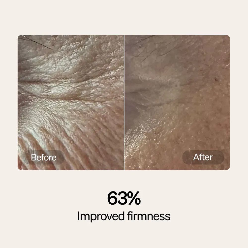 LYMA Serum & Cream Refills