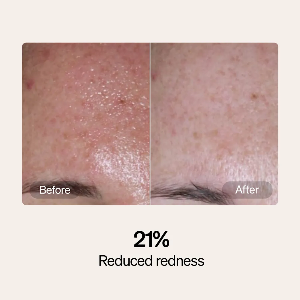 LYMA Serum & Cream Refills