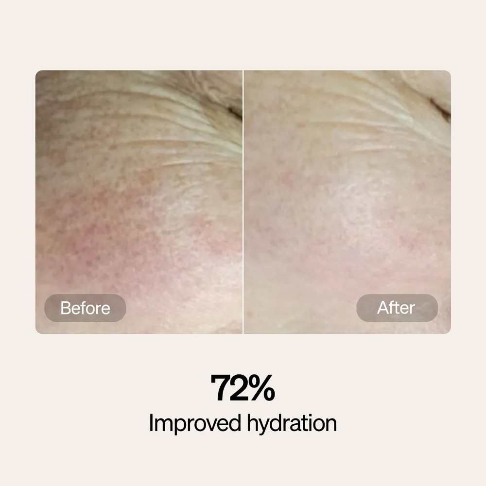 LYMA Serum & Cream Refills