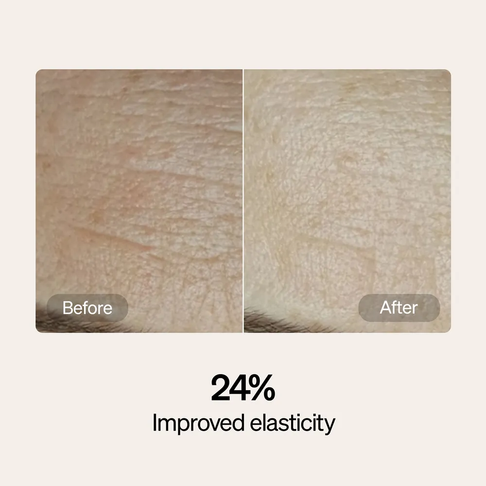 LYMA Serum & Cream Refills